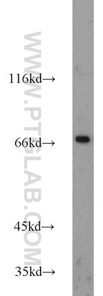 CD138/Syndecan-1 Antibody in Western Blot (WB)