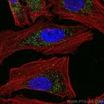 PEX14 Antibody in Immunocytochemistry (ICC/IF)