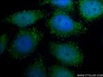 PEX14 Antibody in Immunocytochemistry (ICC/IF)