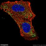 PEX14 Antibody in Immunocytochemistry (ICC/IF)