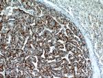 PEX14 Antibody in Immunohistochemistry (Paraffin) (IHC (P))