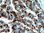 PEX14 Antibody in Immunohistochemistry (Paraffin) (IHC (P))