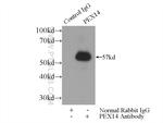 PEX14 Antibody in Immunoprecipitation (IP)