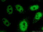 HEY2 Antibody in Immunocytochemistry (ICC/IF)