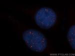 HEY2 Antibody in Immunocytochemistry (ICC/IF)