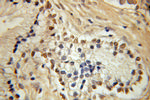 HEY2 Antibody in Immunohistochemistry (Paraffin) (IHC (P))