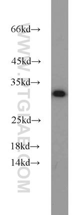 HEY2 Antibody in Western Blot (WB)