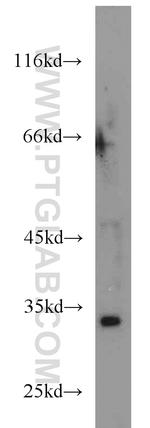 HEY2 Antibody in Western Blot (WB)