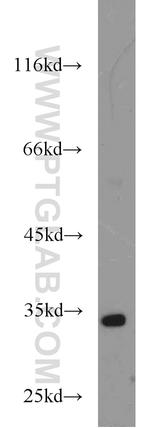 HEY2 Antibody in Western Blot (WB)