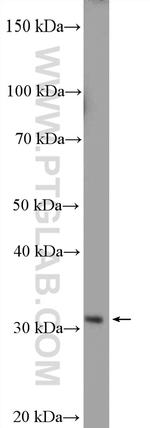 HEY2 Antibody in Western Blot (WB)