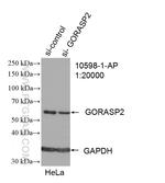 GORASP2 Antibody in Western Blot (WB)