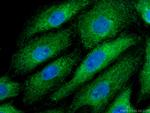 BAG3 Antibody in Immunocytochemistry (ICC/IF)