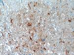 BAG3 Antibody in Immunohistochemistry (Paraffin) (IHC (P))