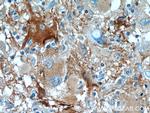 BAG3 Antibody in Immunohistochemistry (Paraffin) (IHC (P))