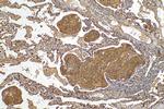 BAG3 Antibody in Immunohistochemistry (Paraffin) (IHC (P))