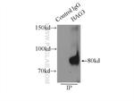 BAG3 Antibody in Immunoprecipitation (IP)