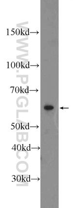 CD24 Antibody in Western Blot (WB)