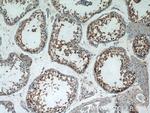 AGPAT1 Antibody in Immunohistochemistry (Paraffin) (IHC (P))