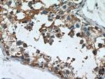 AGPAT1 Antibody in Immunohistochemistry (Paraffin) (IHC (P))