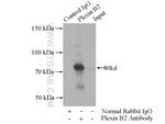 Plexin B2 Antibody in Immunoprecipitation (IP)