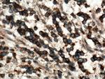 Plexin B2 Antibody in Immunohistochemistry (Paraffin) (IHC (P))