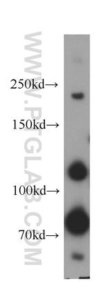 Plexin B2 Antibody in Western Blot (WB)