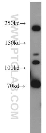 Plexin B2 Antibody in Western Blot (WB)