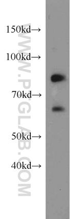 Plexin B2 Antibody in Western Blot (WB)