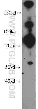 Plexin B2 Antibody in Western Blot (WB)