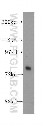 Plexin B2 Antibody in Western Blot (WB)