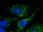 CHRNA1 Antibody in Immunocytochemistry (ICC/IF)