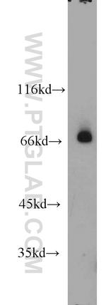 RORA Antibody in Western Blot (WB)