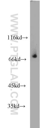 RORA Antibody in Western Blot (WB)