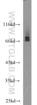 RORA Antibody in Western Blot (WB)