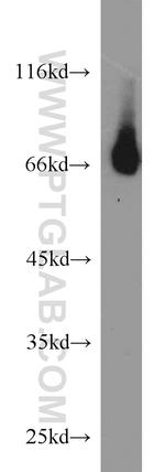 RORA Antibody in Western Blot (WB)