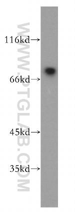 RORA Antibody in Western Blot (WB)