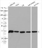 ING4 Antibody in Western Blot (WB)