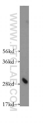 ING4 Antibody in Western Blot (WB)