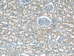 AP1M2 Antibody in Immunohistochemistry (Paraffin) (IHC (P))