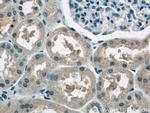 AP1M2 Antibody in Immunohistochemistry (Paraffin) (IHC (P))