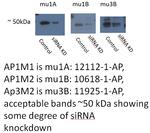 AP1M2 Antibody in Western Blot (WB)