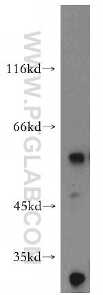 AP1M2 Antibody in Western Blot (WB)