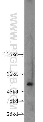 AP1M2 Antibody in Western Blot (WB)