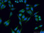 SDHB Antibody in Immunocytochemistry (ICC/IF)