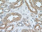 SDHB Antibody in Immunohistochemistry (Paraffin) (IHC (P))