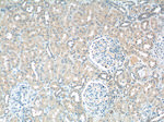 SDHB Antibody in Immunohistochemistry (Paraffin) (IHC (P))