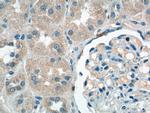 SDHB Antibody in Immunohistochemistry (Paraffin) (IHC (P))