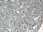 SDHB Antibody in Immunohistochemistry (Paraffin) (IHC (P))