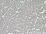 SDHB Antibody in Immunohistochemistry (Paraffin) (IHC (P))