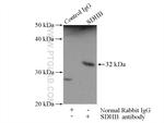SDHB Antibody in Immunoprecipitation (IP)
